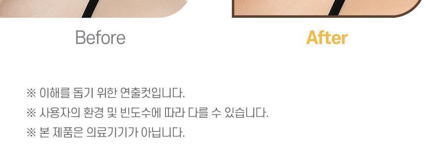 제이킨 피부괄사 상세 안내 - 이해를 돕기 위한 연출컷, 본 제품은 의료기기가 아님